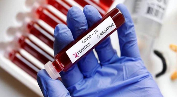 Negative RT-PCR test mandatory for international passengers