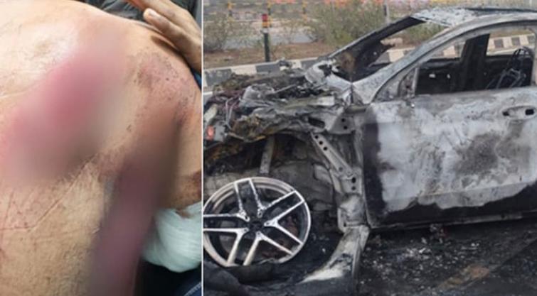 What can we learn from cricketer's accident? 