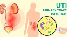 UTI cases among women and children increase during extreme heat