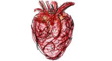 What is an aortic aneurysm? Expert shares causes, symptoms