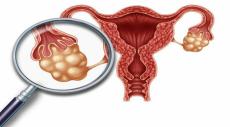 These are the top 5 supplements Indian gynaecologist recommends