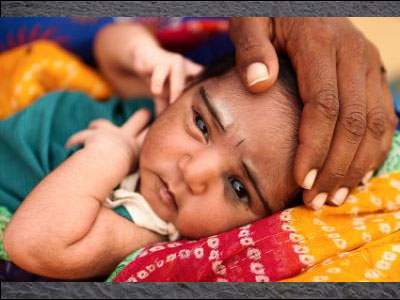 India has highest burden of malnutrition, Health effects of Climate Change