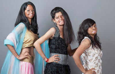 After fashion shoot, documentary on acid attack survivors