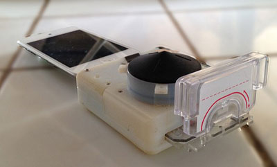 Now a smartphone device that can diagnose HIV in 15 minutes