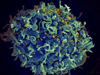 New antibody shows promise in suppressing HIV infection