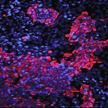 Insulin-producing pancreatic cells created from human skin cells 