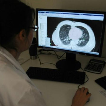 Proton therapy may finally give hope to recurrent lung cancer patients