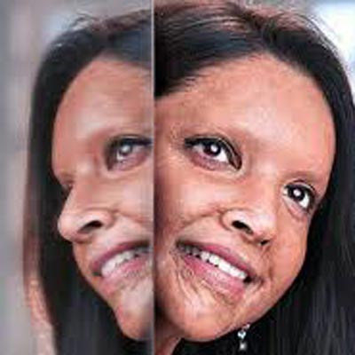 Chhapaak Movie Box Office Day