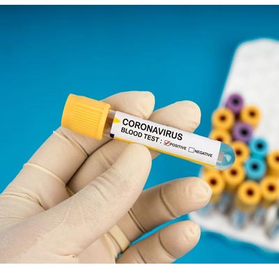 Coronavirus Death Toll Crosses 100 In USA 