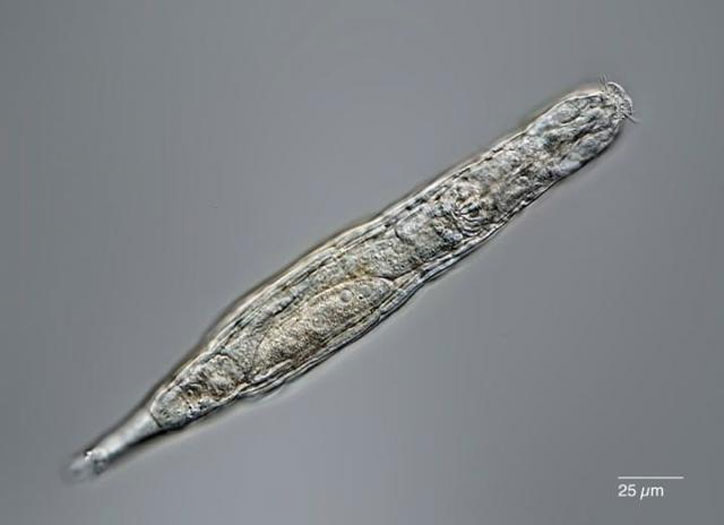 Micro-Animal Frozen In Siberia's Permafrost For 24,000 Years Comes Back To Life