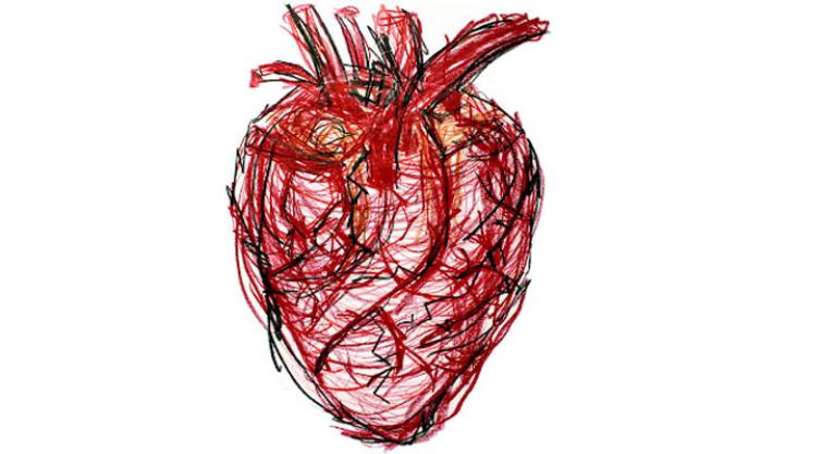 What is an aortic aneurysm? Expert shares causes, symptoms