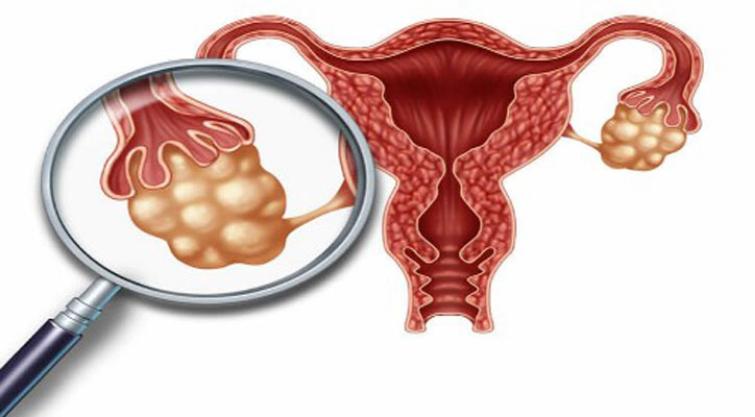 These are the top 5 supplements Indian gynaecologist recommends These are the top 5 supplements Indian gynaecologist recommends